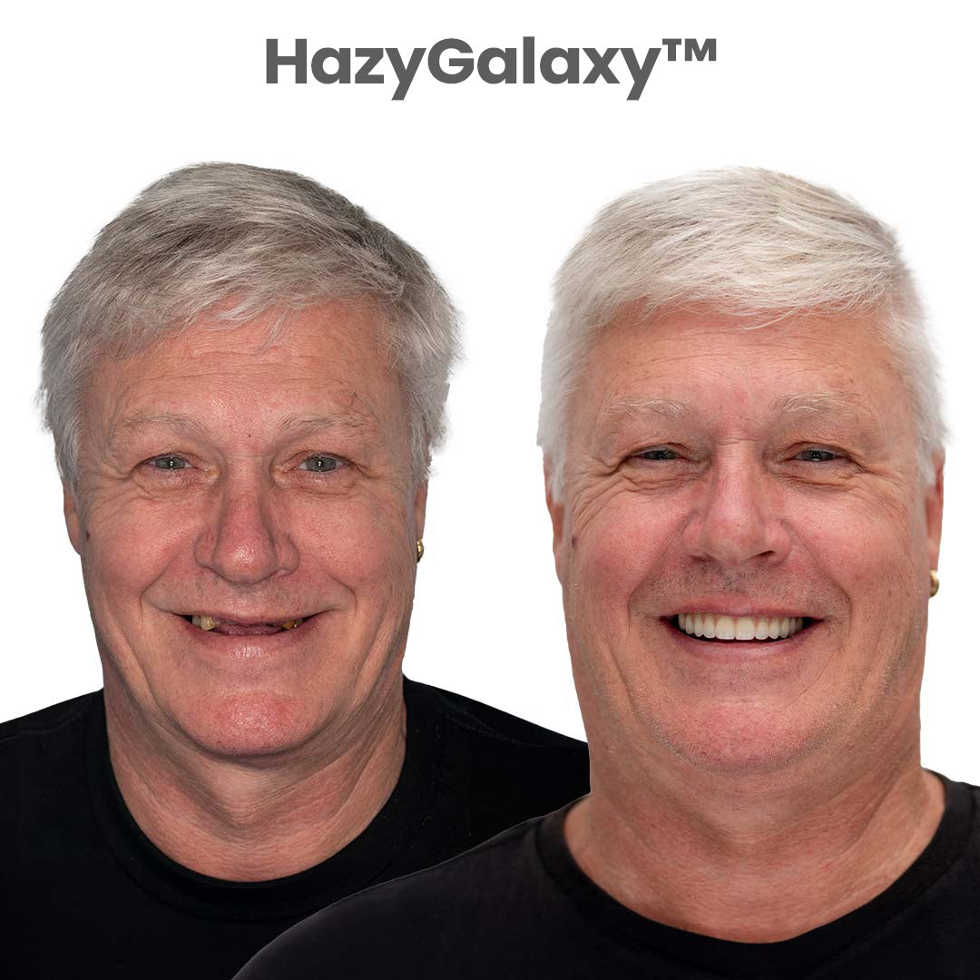 '-🦷 HazyGalaxy™ Custom-Fit Dentures ⏰ ENDS TODAY 70% OFF | Smile with Confidence