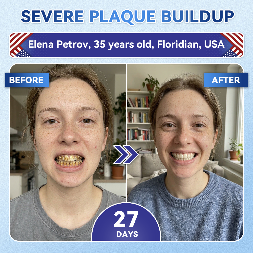 Your Smile~ SpringCherry® 🦷 Tideglusib Fast‑Dissolving Tooth & Gum Repair Oral Strips ✨ (𝟓-𝐢𝐧-𝟏 💎 𝐑𝐞𝐛𝐮𝐢𝐥𝐝 𝐄𝐧𝐚𝐦𝐞𝐥 & 𝐃𝐞𝐧𝐭𝐢𝐧 • 𝐒𝐭𝐫𝐞𝐧𝐠𝐭𝐡𝐞𝐧 𝐆𝐮𝐦𝐬 • 𝐄𝐫𝐚𝐝𝐢𝐜𝐚𝐭𝐞 𝐓𝐚𝐫𝐭𝐚𝐫 & 𝐎𝐝𝐨𝐫 • 𝐖𝐡𝐢𝐭𝐞𝐧𝐢𝐧𝐠 • 𝐒𝐭𝐨𝐩 𝐓𝐨𝐨𝐭𝐡 𝐒𝐞𝐧𝐬𝐢𝐭𝐢𝐯𝐢𝐭𝐲)