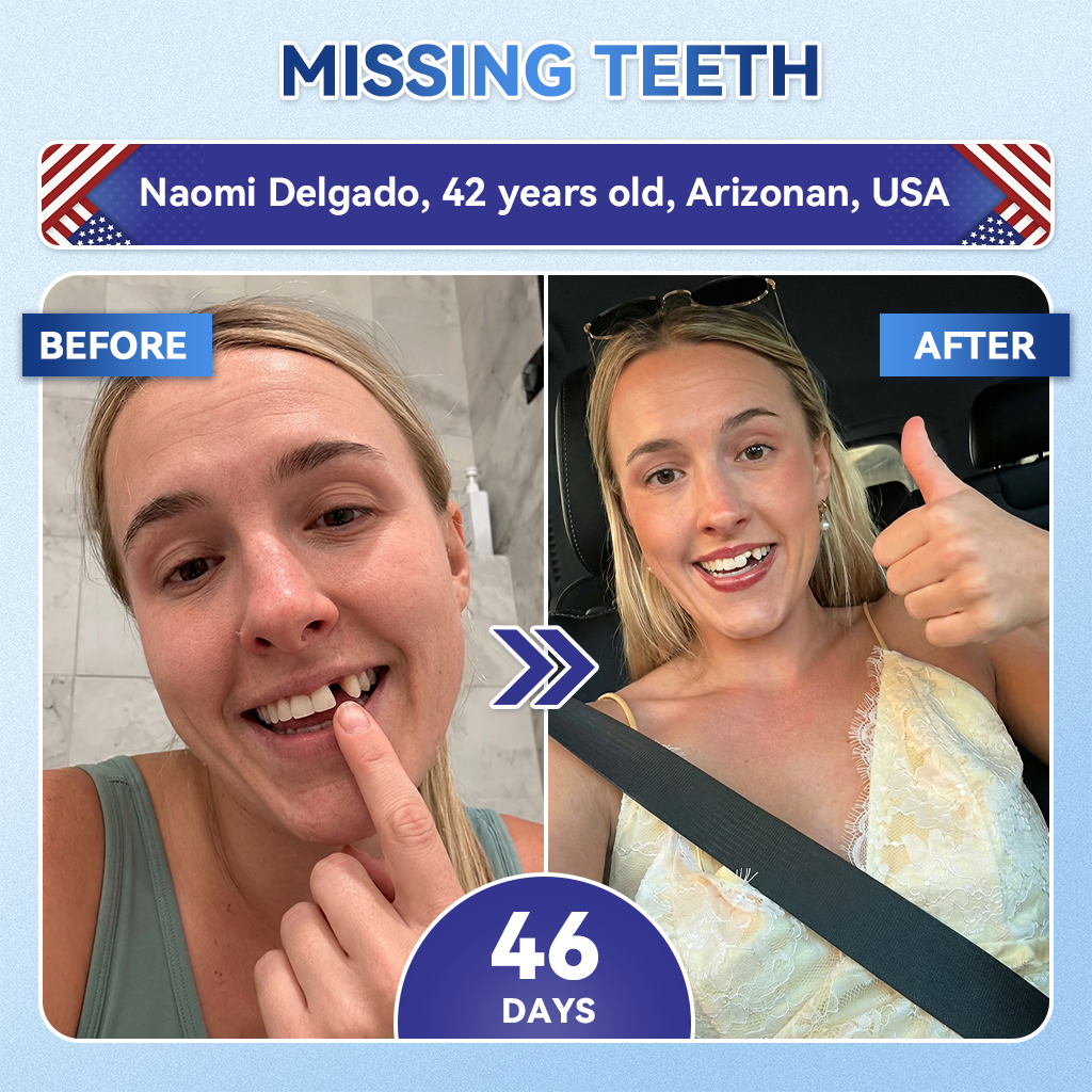 Your Smile~ SpringCherry® 🦷 Tideglusib Fast‑Dissolving Tooth & Gum Repair Oral Strips ✨ (𝟓-𝐢𝐧-𝟏 💎 𝐑𝐞𝐛𝐮𝐢𝐥𝐝 𝐄𝐧𝐚𝐦𝐞𝐥 & 𝐃𝐞𝐧𝐭𝐢𝐧 • 𝐒𝐭𝐫𝐞𝐧𝐠𝐭𝐡𝐞𝐧 𝐆𝐮𝐦𝐬 • 𝐄𝐫𝐚𝐝𝐢𝐜𝐚𝐭𝐞 𝐓𝐚𝐫𝐭𝐚𝐫 & 𝐎𝐝𝐨𝐫 • 𝐖𝐡𝐢𝐭𝐞𝐧𝐢𝐧𝐠 • 𝐒𝐭𝐨𝐩 𝐓𝐨𝐨𝐭𝐡 𝐒𝐞𝐧𝐬𝐢𝐭𝐢𝐯𝐢𝐭𝐲)