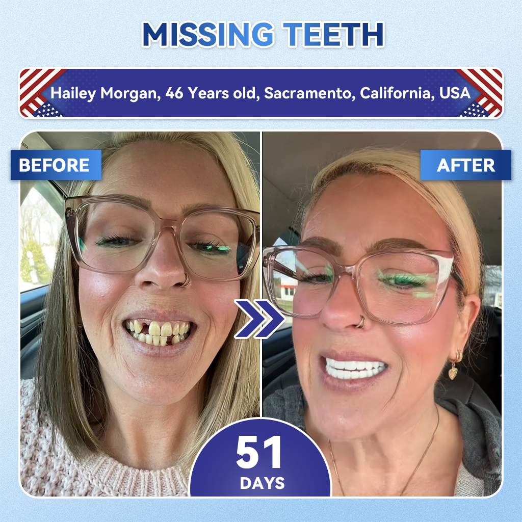 Your Smile~ SpringCherry® 🦷 Tideglusib Fast‑Dissolving Tooth & Gum Repair Oral Strips ✨ (𝟓-𝐢𝐧-𝟏 💎 𝐑𝐞𝐛𝐮𝐢𝐥𝐝 𝐄𝐧𝐚𝐦𝐞𝐥 & 𝐃𝐞𝐧𝐭𝐢𝐧 • 𝐒𝐭𝐫𝐞𝐧𝐠𝐭𝐡𝐞𝐧 𝐆𝐮𝐦𝐬 • 𝐄𝐫𝐚𝐝𝐢𝐜𝐚𝐭𝐞 𝐓𝐚𝐫𝐭𝐚𝐫 & 𝐎𝐝𝐨𝐫 • 𝐖𝐡𝐢𝐭𝐞𝐧𝐢𝐧𝐠 • 𝐒𝐭𝐨𝐩 𝐓𝐨𝐨𝐭𝐡 𝐒𝐞𝐧𝐬𝐢𝐭𝐢𝐯𝐢𝐭𝐲)
