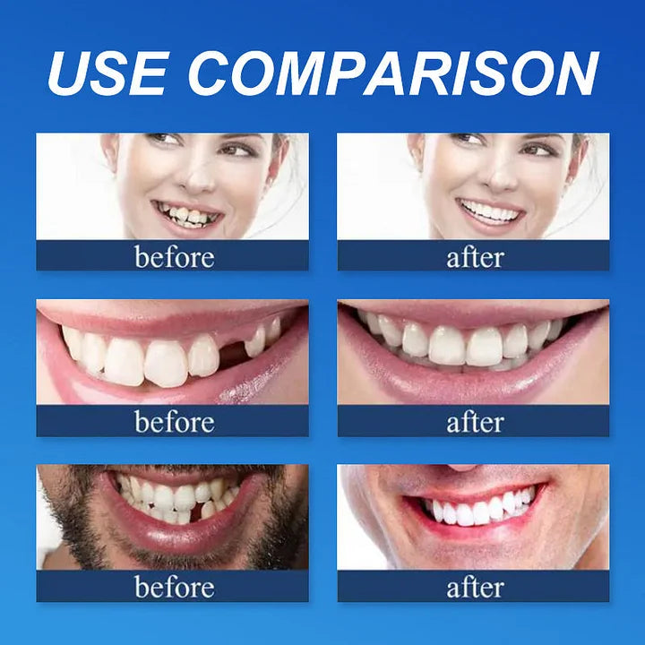 💥Ends Today: 75% OFF! ⏰DarkFairy™ Medical Full Denture with Strong Suctiond Custom-Fit Full Functional Dentures🦷