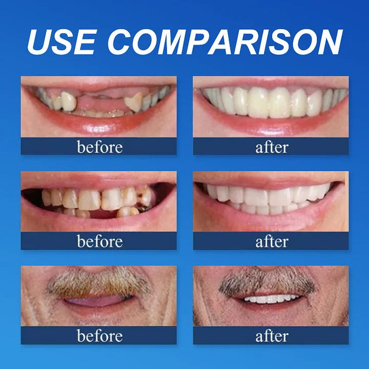 💥Ends Today: 75% OFF! ⏰DarkFairy™ Medical Full Denture with Strong Suctiond Custom-Fit Full Functional Dentures🦷